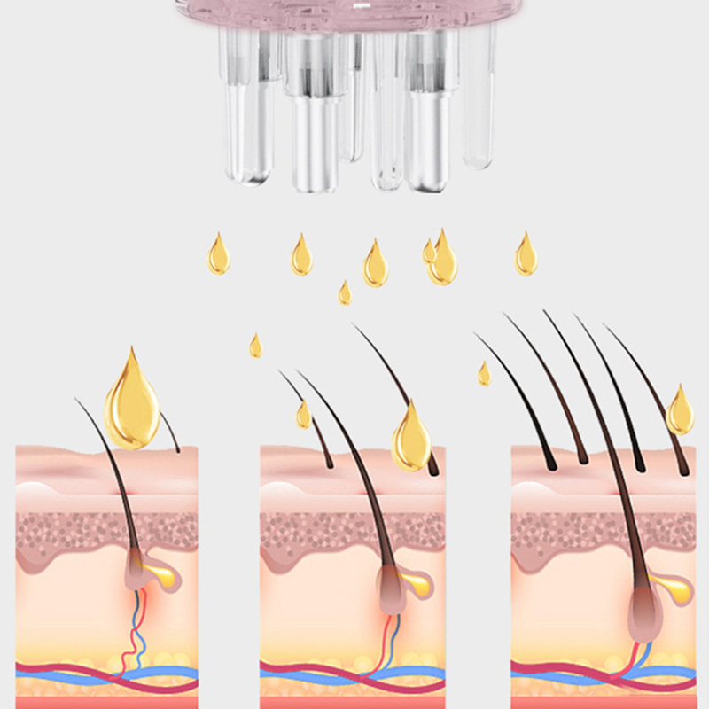 5ml Kopfhaut-Applikator Massag – Root Stimulator Liquid Bewertung und Preis